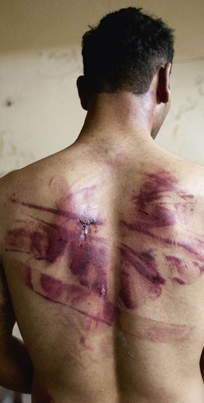 Een Syrische man toont de sporen van marteling op zijn rug nadat hij is vrijgelaten door Assads troepen. Aleppo, 23 augustus 2012.