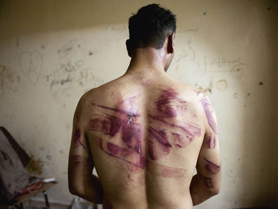 Een Syrische man toont de sporen van marteling op zijn rug nadat hij is vrijgelaten door Assads troepen. Aleppo, 23 augustus 2012.