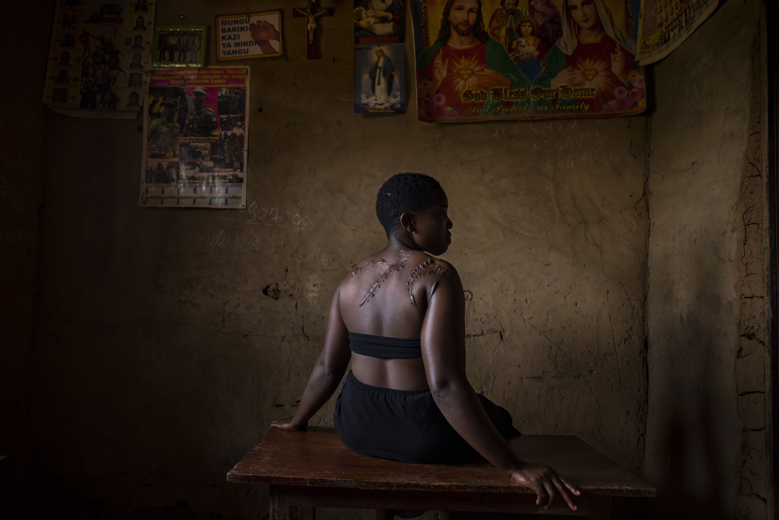 Georgette Ndovya Kavugho uit Congo werd in 2021 het slachtoffer van een aanval van de ADF, die met machetes op haar insloegen.